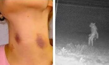 É certo isso, Arnaldo? – Mulher aparece em casa com “chupão” no pescoço e diz ao marido que foi atacada por um lobisomem