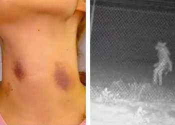 É certo isso, Arnaldo? – Chegou em casa com “chupão” no pescoço e disse ao marido que foi atacada por um lobisomem