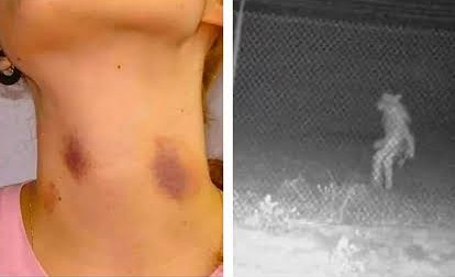 É certo isso, Arnaldo? – Chegou em casa com “chupão” no pescoço e disse ao marido que foi atacada por um lobisomem
